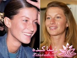 جراحی بینی - جراحی زیبایی